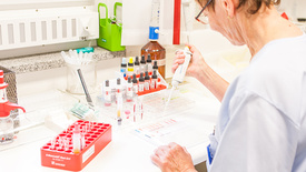 Eine Laborassistentin untersucht eine Blutprobe mittels einer Pipette