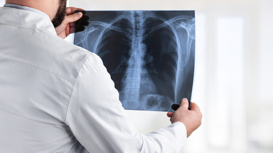 Ein Arzt schaut sich die Röntgenaufnahme eines Brustkorbes an